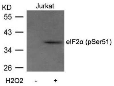 Western Blot: eIF2A [p Ser51] Antibody [NB100-81896]